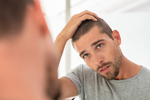 What You Should Know About Hairline Reduction Hair Transplantation?